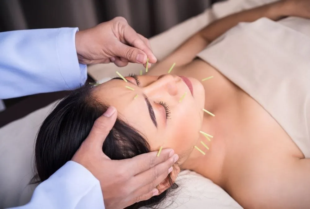 Acupuncture in Surrey