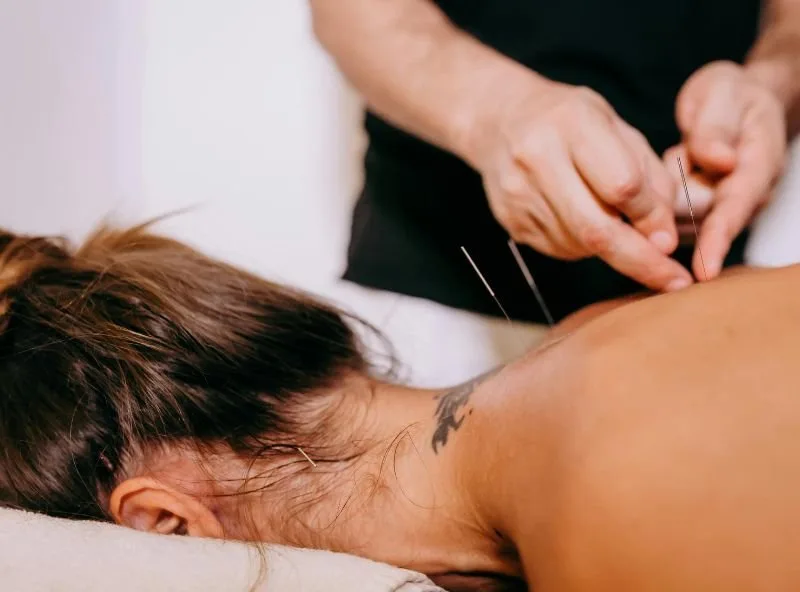 Dry Needling | A Modern Treatment for Muscle Pain and Recovery