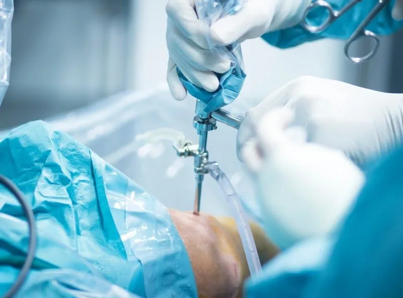 Surgical Orthopedics: Restoring Movement, Relieving Pain